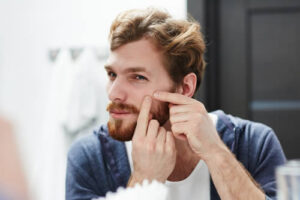 Man popping a pimple on his face